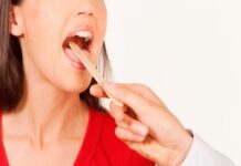 Cần thận trọng với các dấu hiệu của ung thư lưỡi