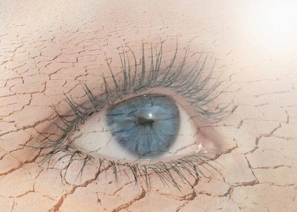 Triệu chứng khô mắt không chỉ gây khó chịu mà còn ảnh hưởng đến hoạt động hàng ngày