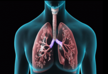 Bệnh xơ phổi thường phát triển ở người cao tuổi