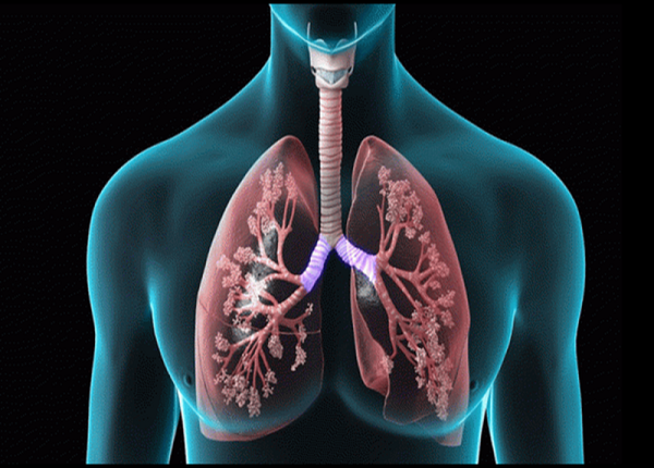 Bệnh xơ phổi thường phát triển ở người cao tuổi