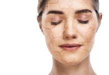 Da khô nứt nẻ không những gây khó chịu mà còn làm mất thẩm mỹ