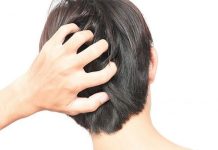 Viêm nang tóc là bệnh lý gây viêm nhiễm các nang tóc trên da đầu